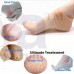 OkaeYa Silicone Heel Protector Anti-Crack Pad Socks Set (1 Pair) Heel Support (Free Size, Beige)